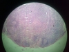lymph-node-3