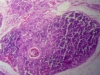 Thymus