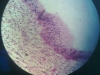 metaplasia-5