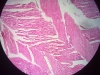 skeletal-muscle-2