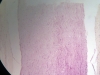 nerve-4