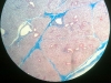 Parotid gland-1