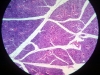 Parotid gland-2