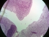 pharyngal-tonsils-1
