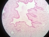 prostate-having-urethra