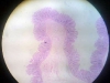 Rectum mucosa and sub-mucosa