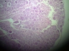 spinal-ganglion