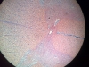 spinal-cord-1
