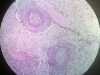spleen-1