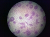 spleen-3