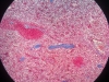 spleen-7