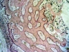spongy-bone-7