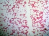 spongy-bone-9