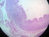 Stomach-3