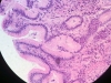 stomach-6
