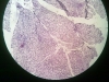sublingual gland-1
