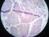 sublingual gland-2