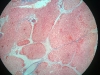 thymus-4