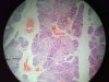 thymus-6