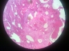 thyroid-simple-cuboidal