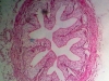 ureter-1