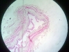 ureter-2