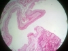 urinary bladder-2