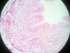 urinary bladder-3