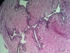 fallopin-tube-4
