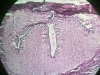 uterine-tube-4