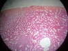 uterus-1