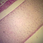 Cartilage