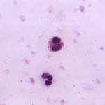Eosinophil
