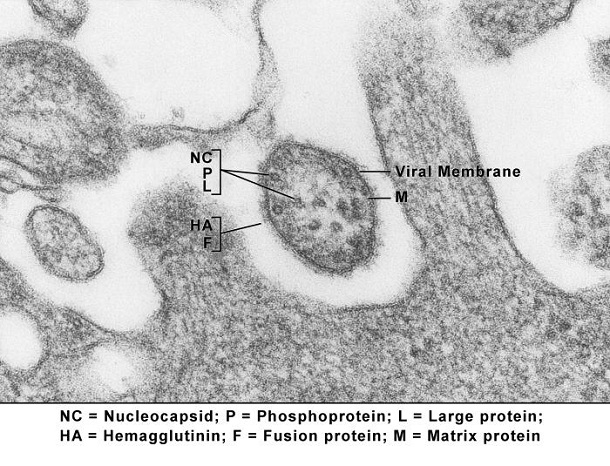 Measles Measles virus