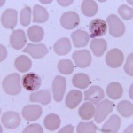 Plasmodium malariae schizont
