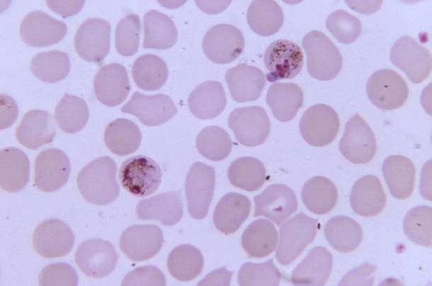 Plasmodium falciparum schizont 2