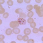 Plasmodium vivax trophozoite