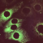 Rubella virus
