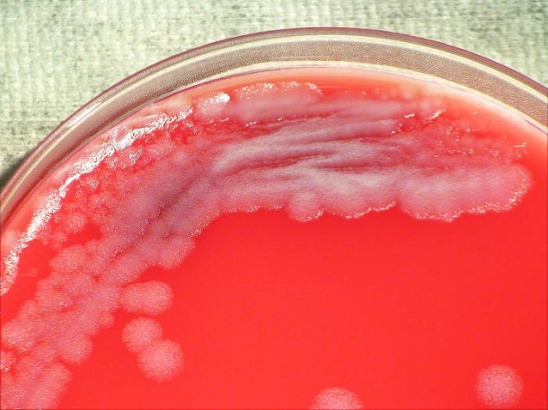 bacillus anthracis colony
