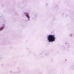 Plasmodium falciparum gametocyte