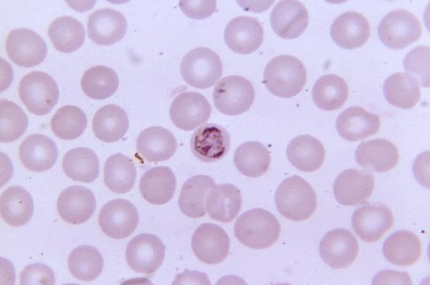 plasmodium falciparum schizont