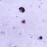 Plasmodium vivax gametocyte