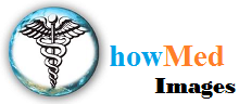 howMed Images