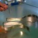 Deaver’s Retractor