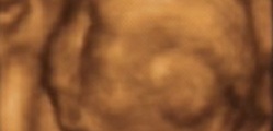 Gynaecology