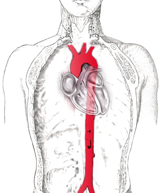 aorta
