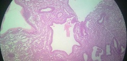 Histopathology
