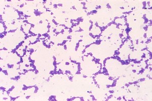 staphylococcus aureus