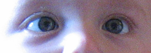 Squint