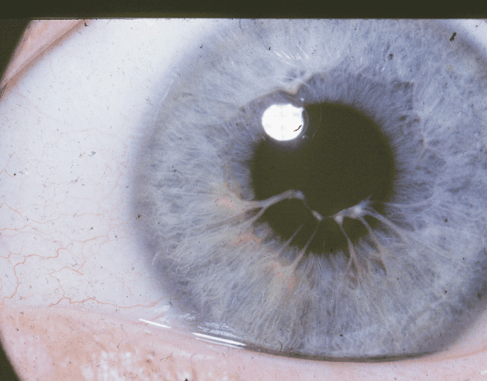 pupil